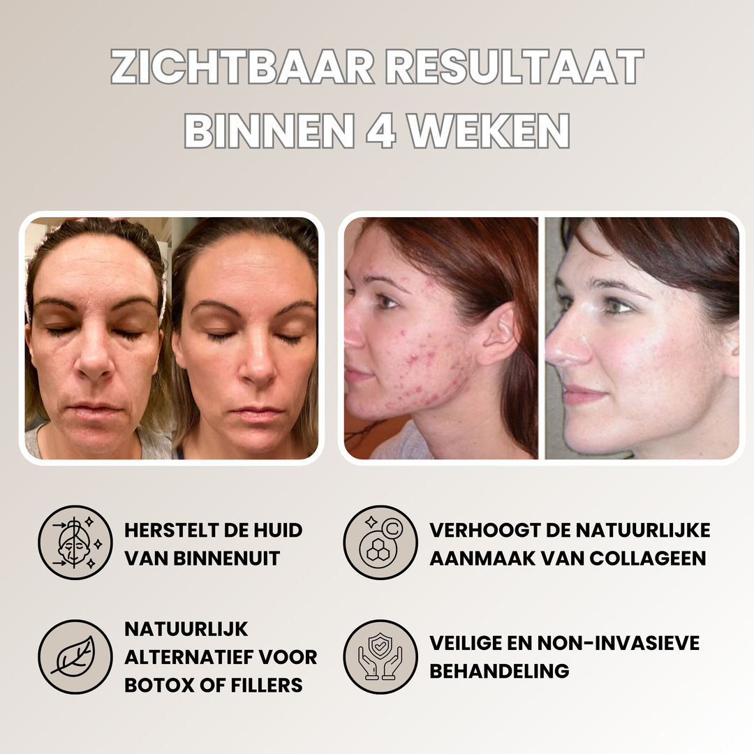 Lunvre LED Gezichtsmasker